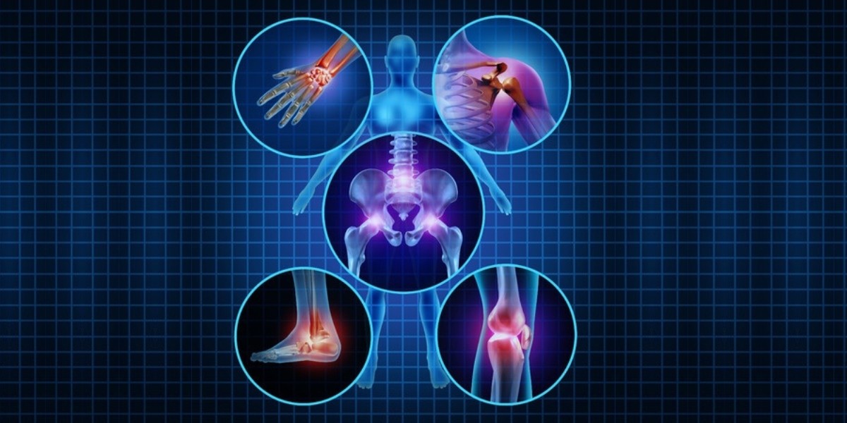 Osteoartrite